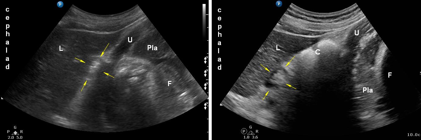 Legend: C: colon; F: foetus; L: liver; P: pancreas; Pla: placenta; U: uterus wall; Yellow arrows: empty antrum.